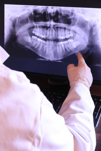 Best Emergency Tooth Extraction in Lillington, NC