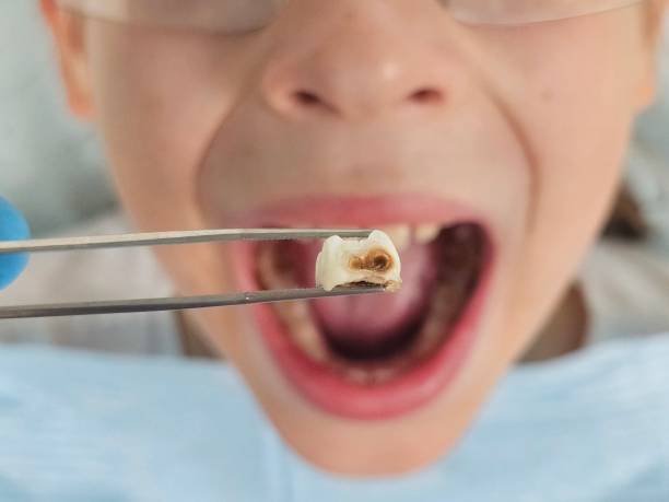 Best Cosmetic Emergency Dentistry in Lillington, NC