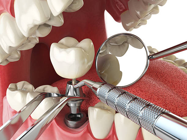 Best Weekend Emergency Dentist in Lillington, NC