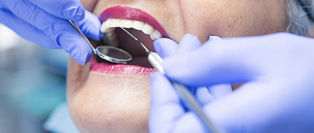 Best Emergency Tooth Extraction in Lillington, NC